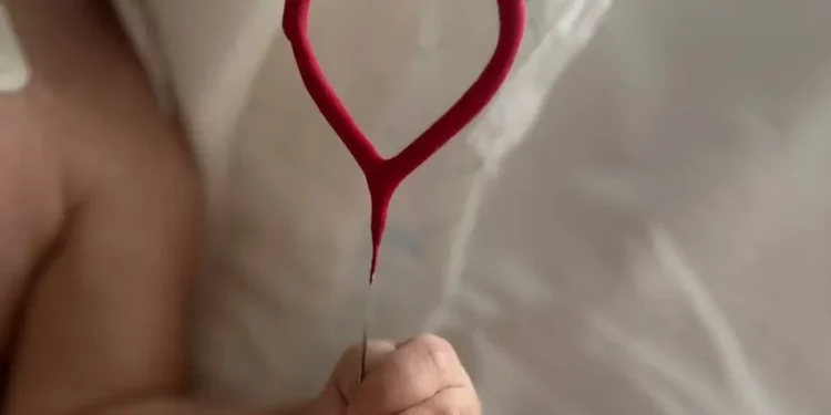 XOXZ5BORRRG3LJWW2IG5EGPBA4 Primer trasplante en niños en Argentina: corazón donado en asistolia controlada