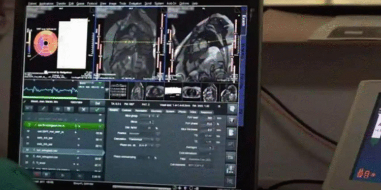 1003743841267 257161295 1706x960 Microsoft desarrolla una IA que supera a médicos en diagnósticos complejos